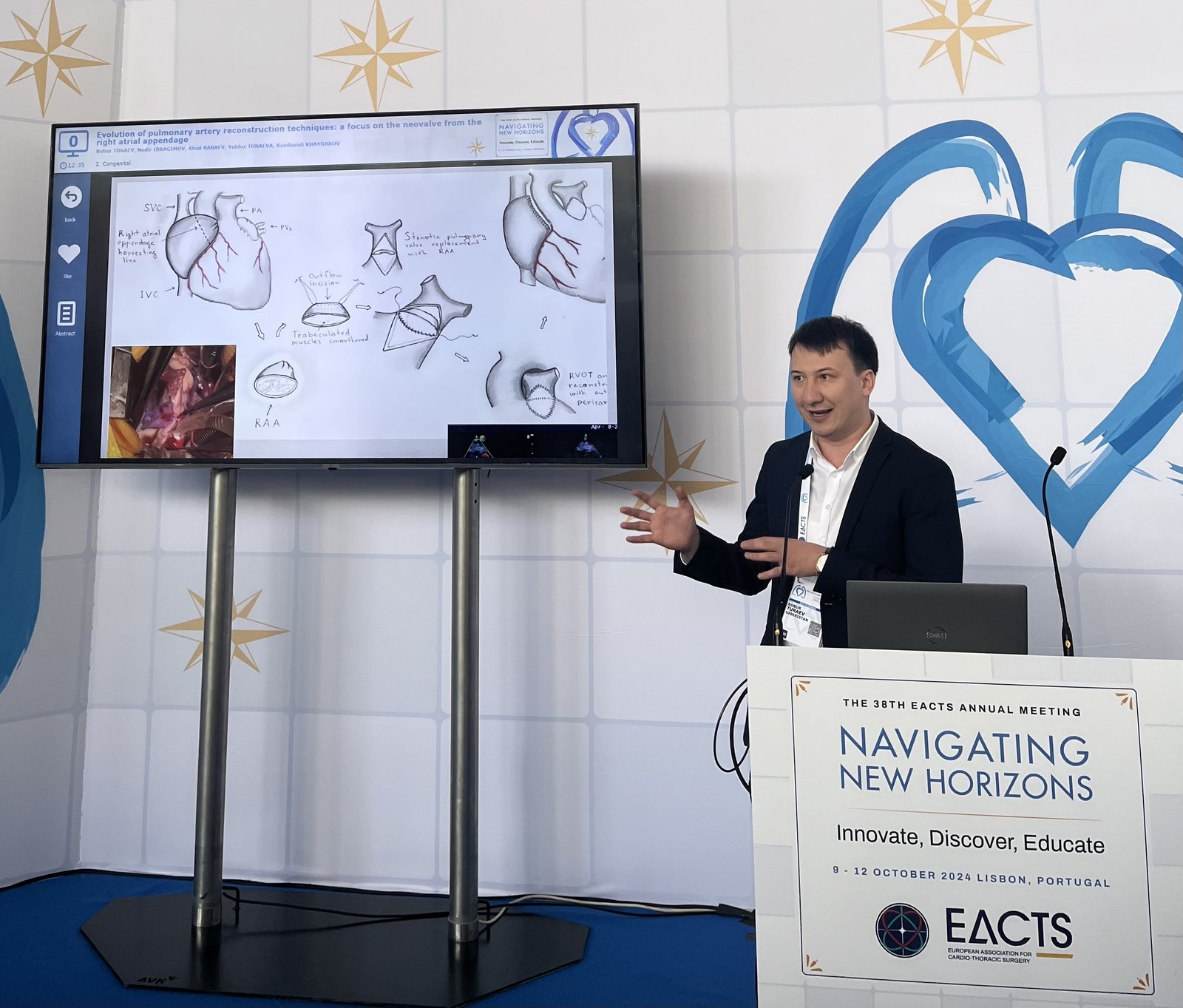 Poster presentation at EACTS Annual Meeting, Lisbon